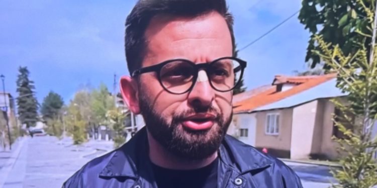 Ia thyhen hundën militantët demokratë/ Flet Erion Isai: Akt i turpshëm, tregon…