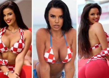 Modelja e Botërorëve: E ndava të dashurin sapo u bëra virale, kishim 10 vite të lidhur…