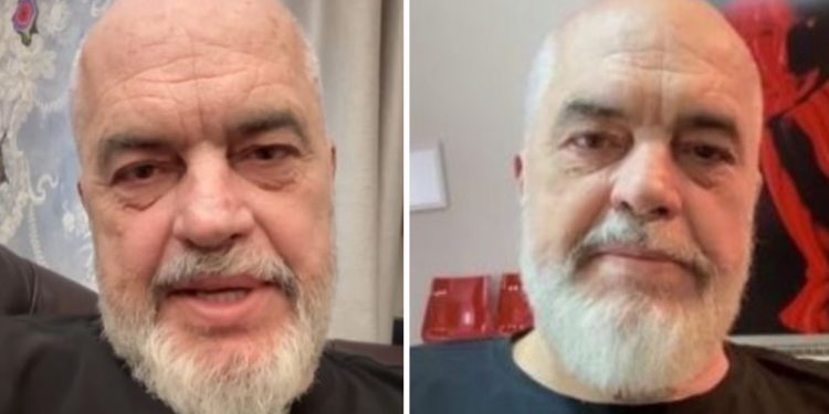 LAJM I FUNDIT…| Rama tregon “mikun special”, kush vjen për herë të parë në Shqipëri si…