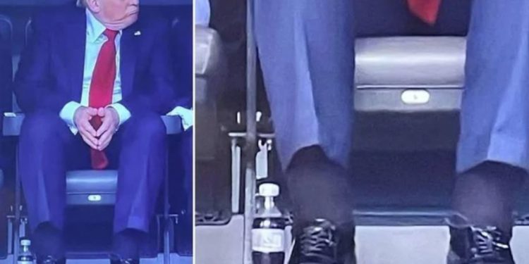 Shenja të pazakonta në trupin e Trump. Ja nga se vuan presidenti i SHBA…