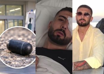 “Vazhdoj ta kem ende plumbin e gomës në sy”/ Rrëfimi tronditës i protestuesit! Si ndodhi ngjarja rëndë