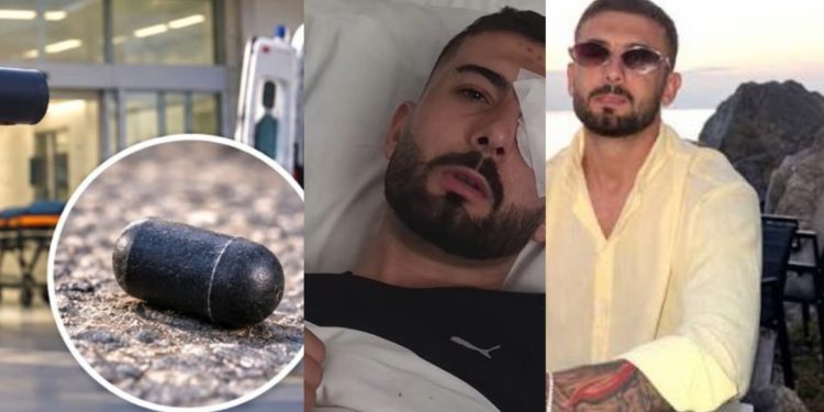 “Vazhdoj ta kem ende plumbin e gomës në sy”/ Rrëfimi tronditës i protestuesit! Si ndodhi ngjarja rëndë